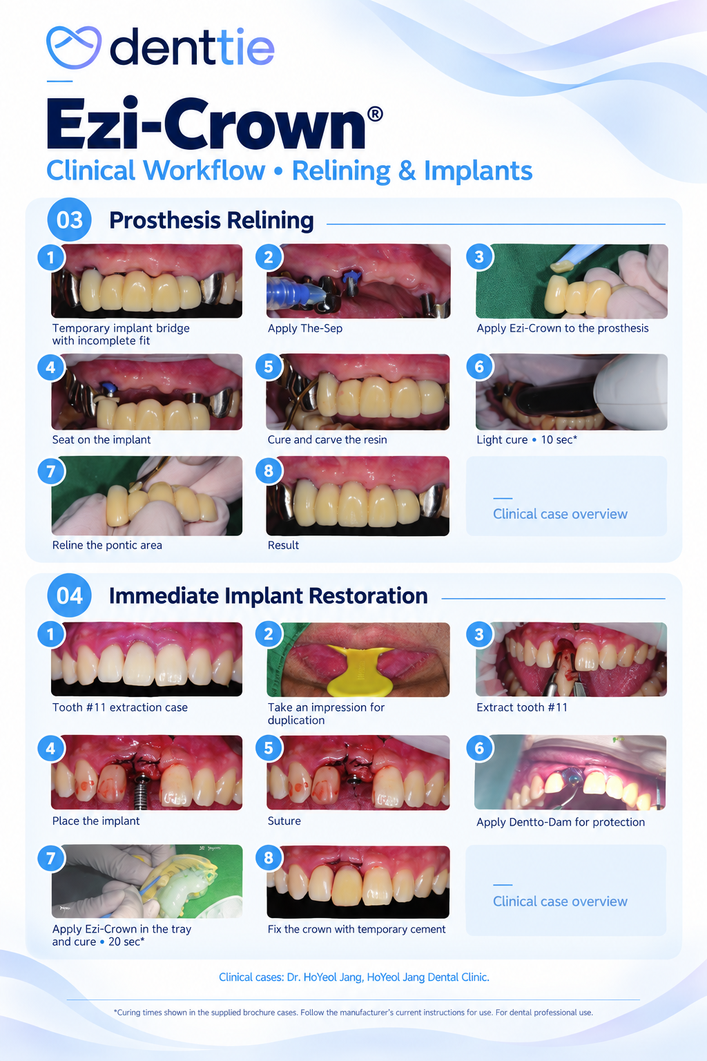 Ezi-Crown® Light-Cured Temporary Crown & Bridge Resin | 15g × 2