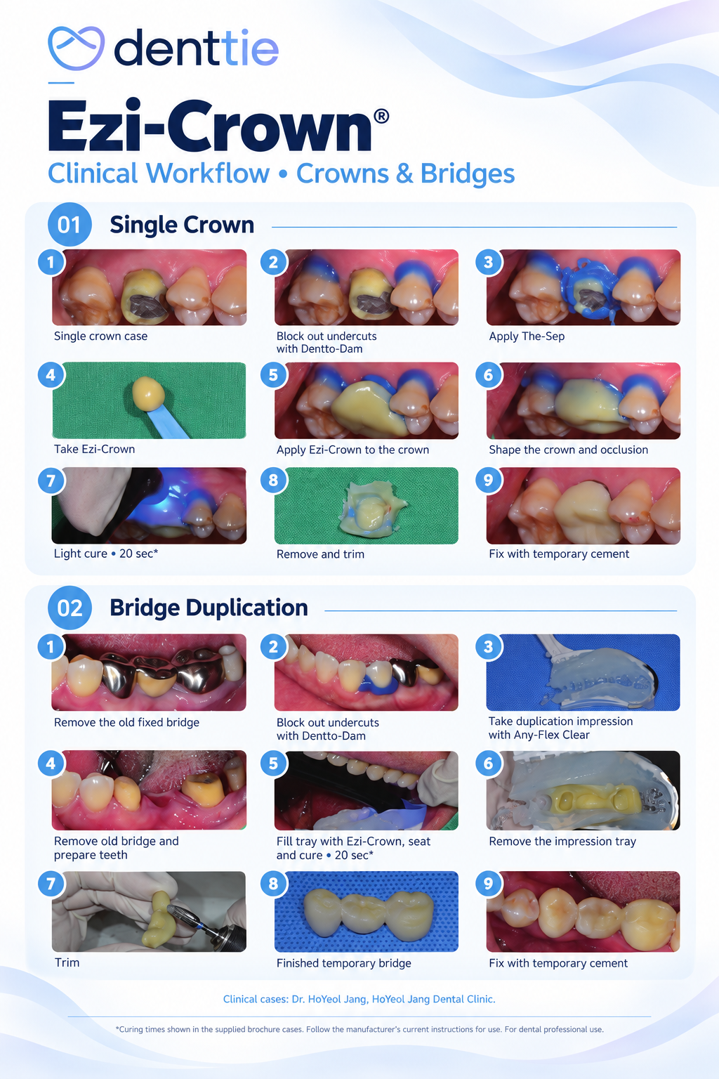 Ezi-Crown® Light-Cured Temporary Crown & Bridge Resin | 15g × 2